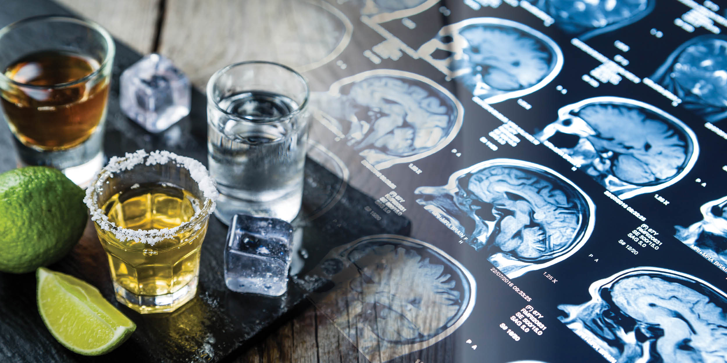 Alcohol and Epilepsy The Recovery Village Palm Beach at Baptist Health